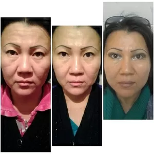 услуги косметолога акция